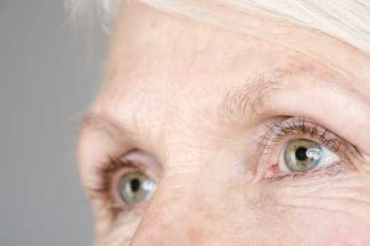 Age-Related Macular Degeneration Explained