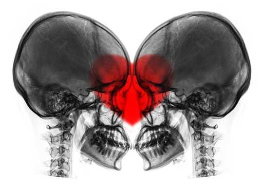 Is Love Just A Fleeting High Fuelled By Brain Chemicals?