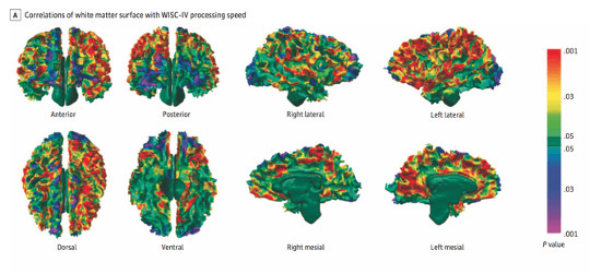 brain picture2