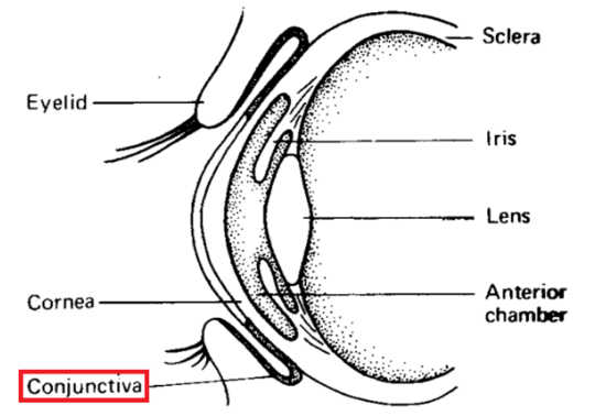 Conjunctivitis 10 11