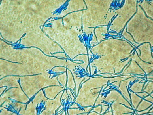 Penicillium, the source of the antibiotic penicillin Michael Taylor