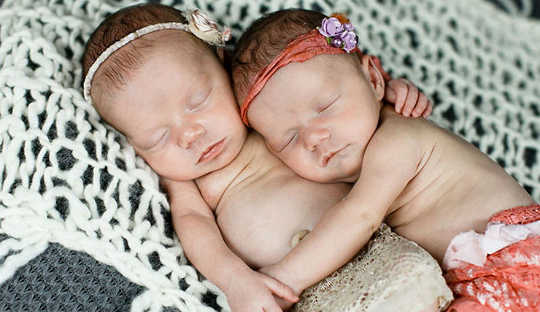 Do Twins Live Longer Because They’re So Close?