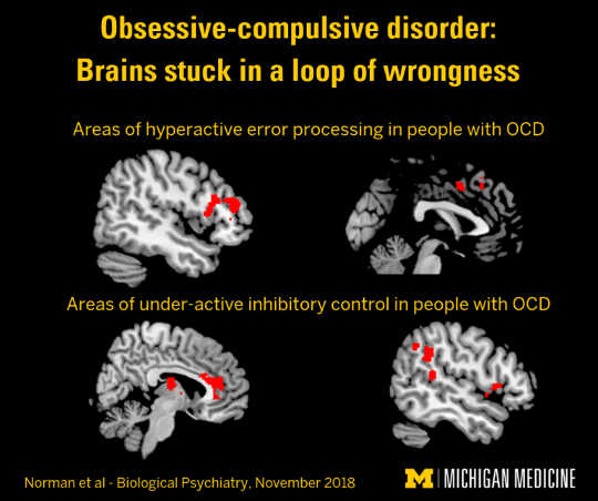 How People With OCD Get Stuck In A Loop Of Wrongness