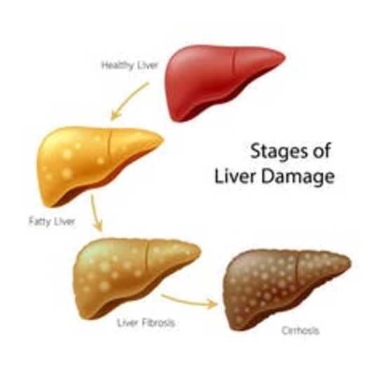 Gut Microbes Can Get You Drunk And Damage Your Liver