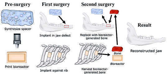 How This Method Grows A New Jawbone From A Rib