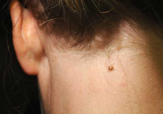 Ticks Spread Plenty More Than Lyme Disease