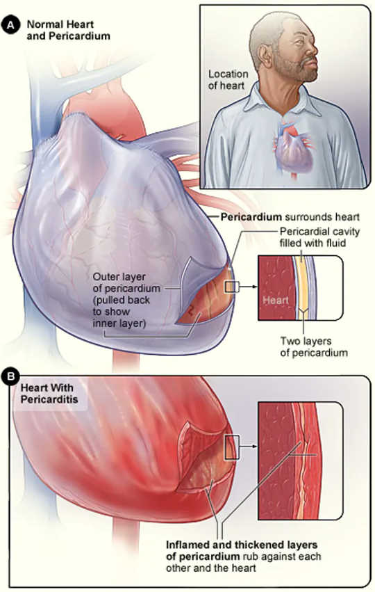 even if you re asymptomatic why covid 19 can harm your heart