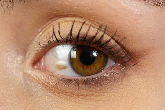 eyes predict health5 4 9