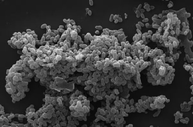 Microscopy image of a large clump of spherical microbes