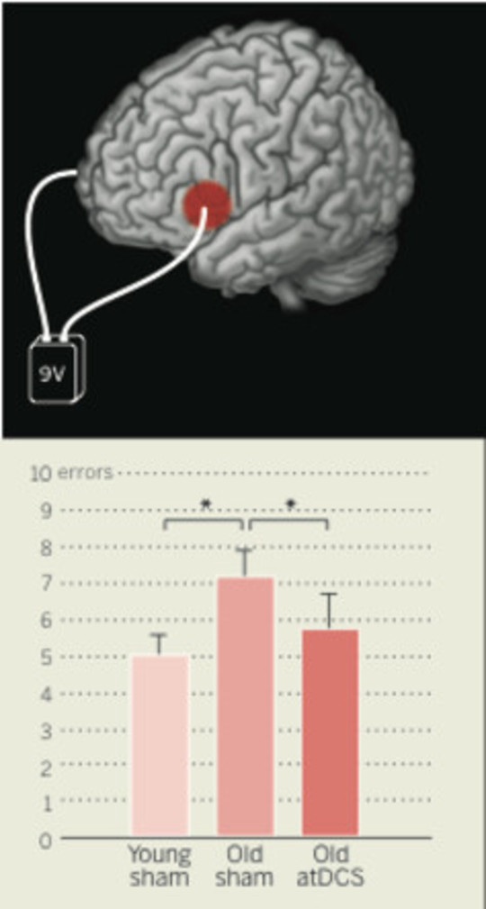 mri brain scan2