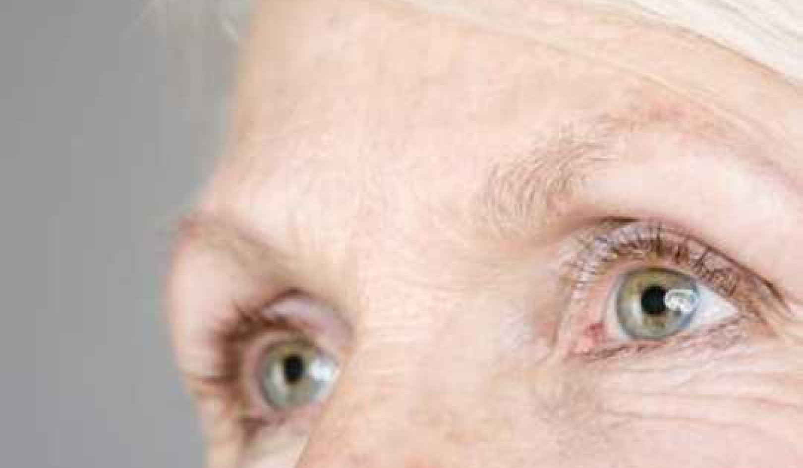 Age-Related Macular Degeneration Explained