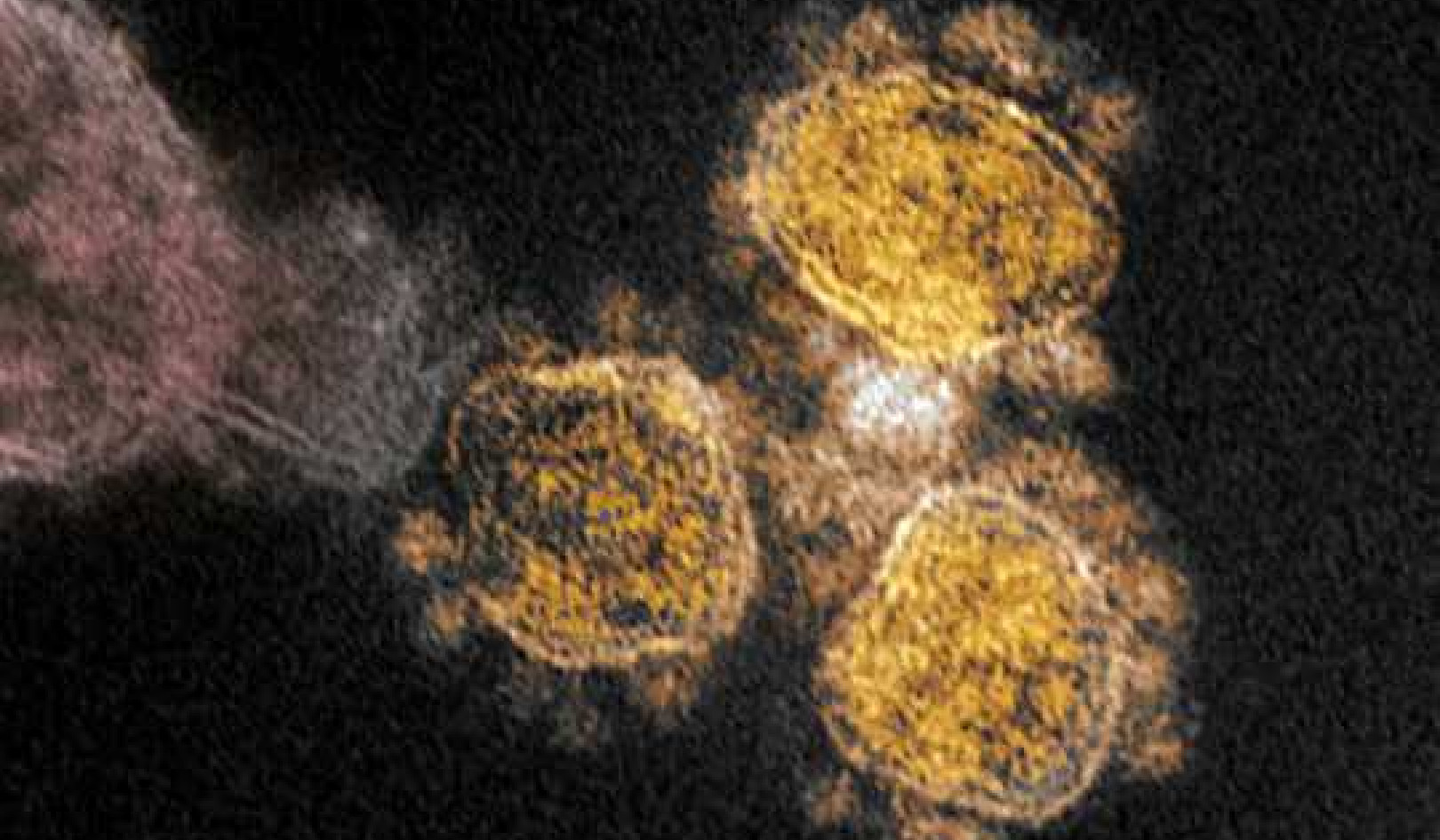 How To Stay Safe With A New Coronavirus Variant On The Loose