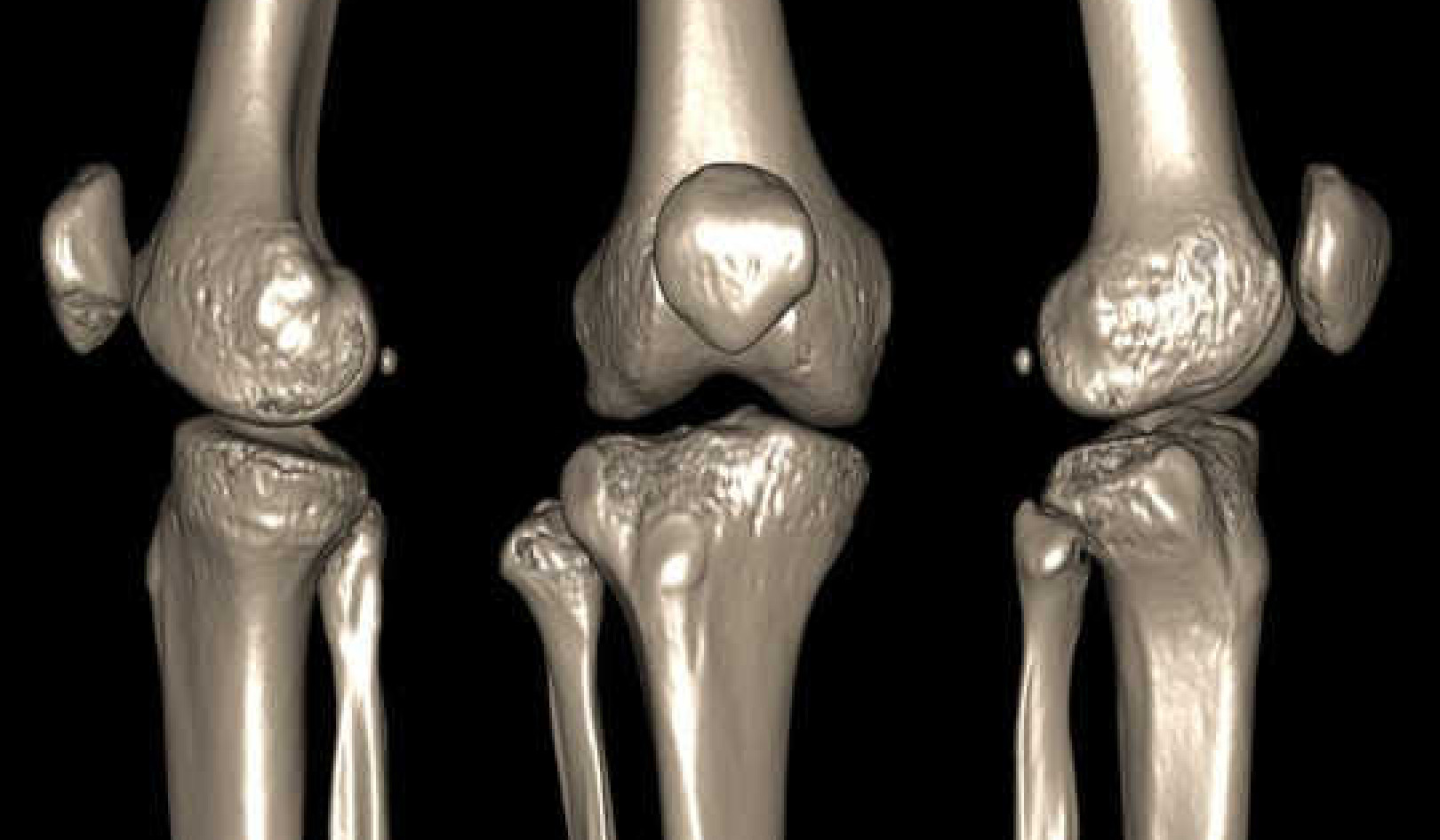 When Joints Pop And Crack Is It A Sign Of Disease?