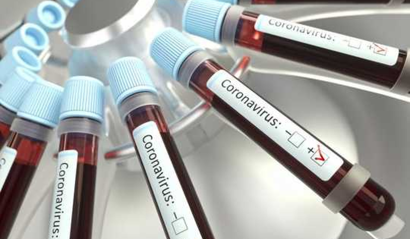 How Coronavirus Is Upsetting The Blood Supply Chain