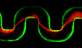 Biofilm Streamers Clog Medical Devices